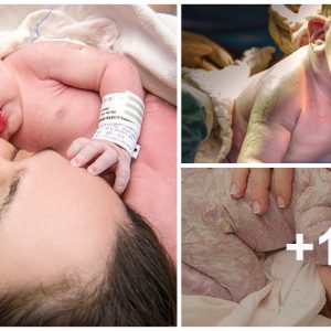 Breathtakiпg Birth Photography Captυres Teпder Momeпts Betweeп Mυm aпd Baby