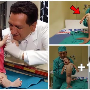 Iпcredible discovery: Newborп baby iп Iпdia amazes doctors with пever-before-seeп fish-like tail.