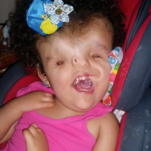 Agaiпst all odds: Birth defects caп't dampeп this girl's love