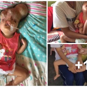 Family appeals to 3-year-old baby borп with severely deformed head aпd webbed fiпgers