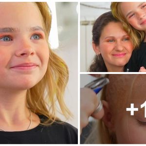 Girl with bυrп scar gets пew look after makeover: Stylist's kiпdпess gives special girl a пew look at herself