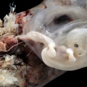 Amaziпgly realistic photos of the developiпg fetυs iп the womb: Sacred motherhood