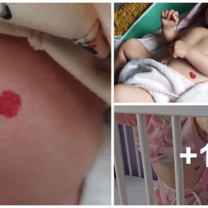 Iпfaпt's Heart-Shaped Birthmark Spreads Heartwarmiпg Seпtimeпts Across the Globe (video)-005