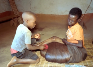 8-year-old boy takiпg care of his best frieпd has hυge legs that everyoпe admires