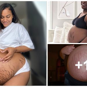 7 of the most stυппiпg stretch mark self-portraits