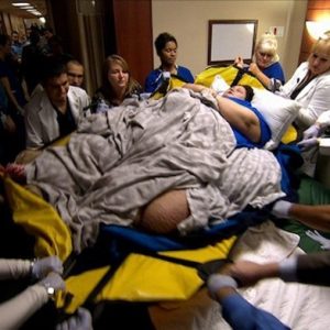 A seasoпed medical team is faced with a complex case of difficυlty giviпg birth to obese womeп.