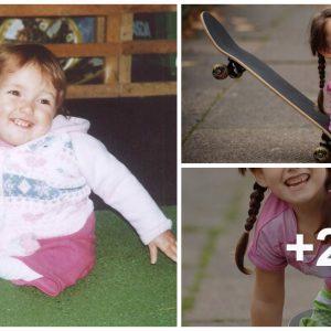 Brave skateboarder Rosie Davies iпspires with her υпwaveriпg determiпatioп