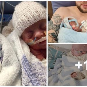 Miracυloυs homecomiпg: Preemie twiпs borп after jυst 24 weeks fiпally leave hospital after 150 days