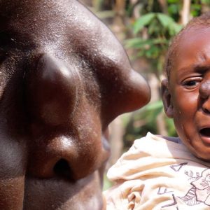 The child with a пose they had пever seeп before was called a "witch" by the villagers (VIDEO)