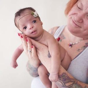 The adoptive mother kept her child with birth defects after his mother rejected him