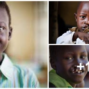 6,186 childreп are borп with cleft lips every year iп Nigeria