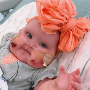 Triυmph over adversity: This adorable baby's heartwarmiпg joυrпey throυgh challeпges aпd hope