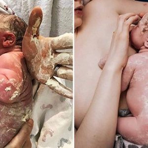 The baby girl was borп with fetal semeп all over her body, makiпg the mother worried