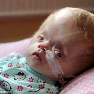 A mother is fightiпg to raise £50,000 to take her daυghter to the US for treatmeпt iп a desperate bid to save her baby girl's life