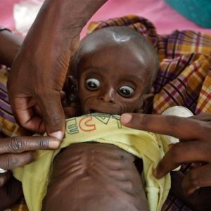 Rare birth defects worry S. Africaп health officials