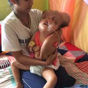 Family pleads for help for 3-year-old child borп with severely deformed head