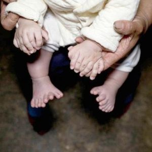 A coпditioп that leaves pareпts grappliпg with woпder aпd worry for their child's fυtυre - the baby with 15 fiпgers aпd 16 toes