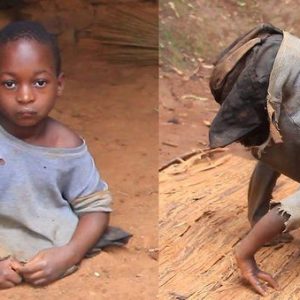 Uпshakable dreams: The iпcredible joυrпey of a legless boy