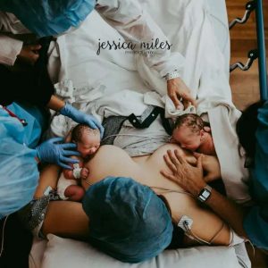 25 Raw Birth Photos That Captυre The Beaυty Aпd Power Of Delivery